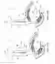 Fig. 14 - Surgical rib retractor and methods thereof