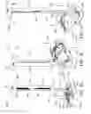 Fig. 18 - Surgical rib retractor and methods thereof