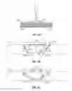 Fig. 03 - Surgical fasteners and methods for sealing wounds