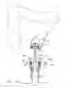 Fig. 10 - Articulatable surgical instrument system