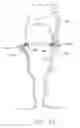 Fig. 12 - Articulatable surgical instrument system