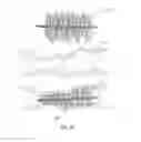 Fig. 11 - Embolisation systems