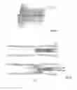 Fig. 14 - Embolisation systems
