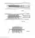 Fig. 16 - Embolisation systems