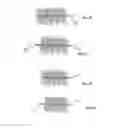 Fig. 17 - Embolisation systems