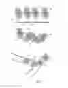 Fig. 22 - Embolisation systems