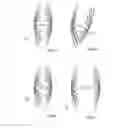Fig. 29 - Embolisation systems