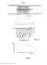 Fig. 48 - Embolisation systems