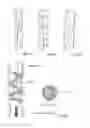Fig. 50 - Embolisation systems