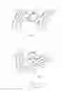 Fig. 63 - Embolisation systems
