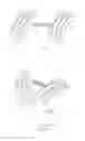 Fig. 65 - Embolisation systems