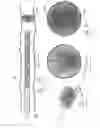 Fig. 85 - Embolisation systems