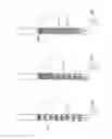 Fig. 87 - Embolisation systems