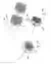 Fig. 91 - Embolisation systems
