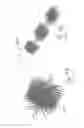 Fig. 93 - Embolisation systems