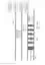 Fig. 97 - Embolisation systems