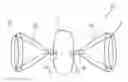 Fig. 01 - VASCULAR PLUG