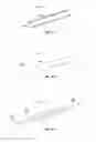 Fig. 07 - Methods and apparatus for treating vertebral fractures