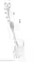 Fig. 09 - Methods and apparatus for treating vertebral fractures