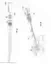 Fig. 22 - Methods and apparatus for treating vertebral fractures