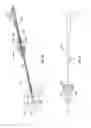 Fig. 26 - Methods and apparatus for treating vertebral fractures