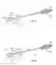 Fig. 31 - Methods and apparatus for treating vertebral fractures