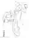 Fig. 06 - INSTRUMENT FOR FRACTURE FRAGMENT ALIGNMENT AND STABILIZATION