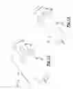 Fig. 08 - Surgical tool for removing kidney stone
