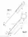 Fig. 10 - Surgical tool for removing kidney stone