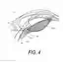 Fig. 09 - Supercavitating medical probe and method of use