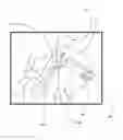 Fig. 01 - Surgical Device