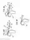 Fig. 08 - Dilator for accessing a joint space
