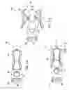 Fig. 02 - METHODS AND APPARATUS FOR PREVENTING VAGINAL LACERATIONS DURING CHILDBIRTH