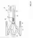 Fig. 05 - METHODS AND APPARATUS FOR PREVENTING VAGINAL LACERATIONS DURING CHILDBIRTH