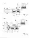 Fig. 08 - METHODS AND APPARATUS FOR PREVENTING VAGINAL LACERATIONS DURING CHILDBIRTH