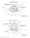 Fig. 18 - METHODS AND APPARATUS FOR PREVENTING VAGINAL LACERATIONS DURING CHILDBIRTH