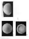 Fig. 08 - Methods and Systems For Local Administration of Therapeutics