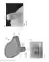Fig. 11 - Methods and Systems For Local Administration of Therapeutics
