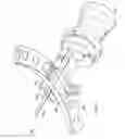 Fig. 02 - Wire tensioner tip for use with wire fixation bolt