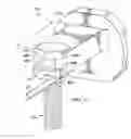 Fig. 08 - Wire tensioner tip for use with wire fixation bolt
