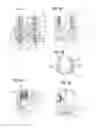 Fig. 03 - Coupling assembly and polyaxial bone anchoring device comprising the same