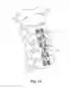 Fig. 08 - Cervical spine stabilization system with extendable plates