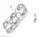 Fig. 10 - Cervical spine stabilization system with extendable plates
