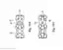 Fig. 14 - Cervical spine stabilization system with extendable plates