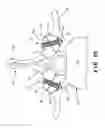 Fig. 03 - Bioactive fusion device