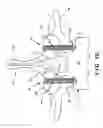 Fig. 04 - Bioactive fusion device