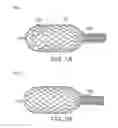 Fig. 02 - Delivery of apparatus and methods for vertebrostenting