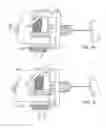 Fig. 15 - Delivery of apparatus and methods for vertebrostenting