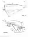 Fig. 25 - Delivery of apparatus and methods for vertebrostenting