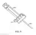 Fig. 26 - Delivery of apparatus and methods for vertebrostenting